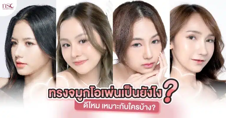 ทรงจมูกโอเพ่น เป็นยังไง ดีไหม เหมาะกับใครบ้าง-01