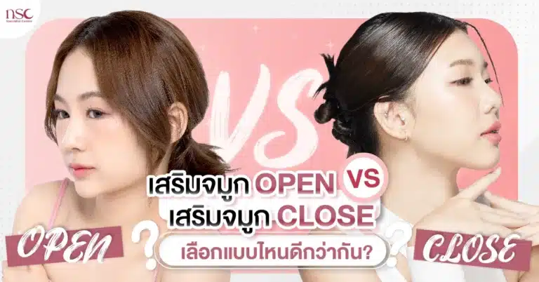 เสริมจมูกopen