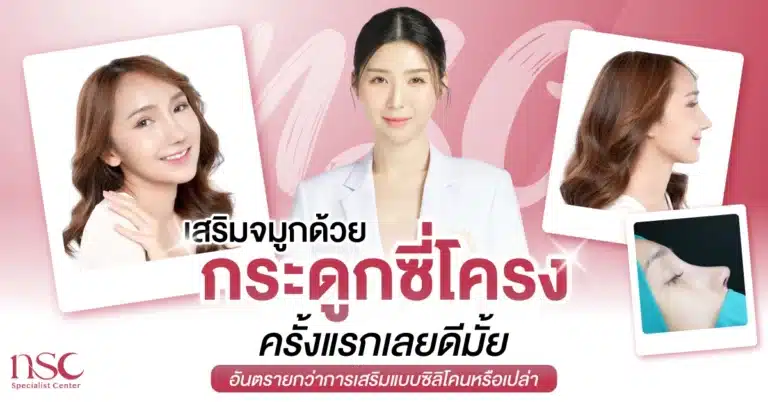 เสริมจมูกด้วยกระดูกซี่โครงครั้งแรกเลยดีมั้ย อันตรายกว่าการเสริมแบบซิลิโคนหรือเปล่า