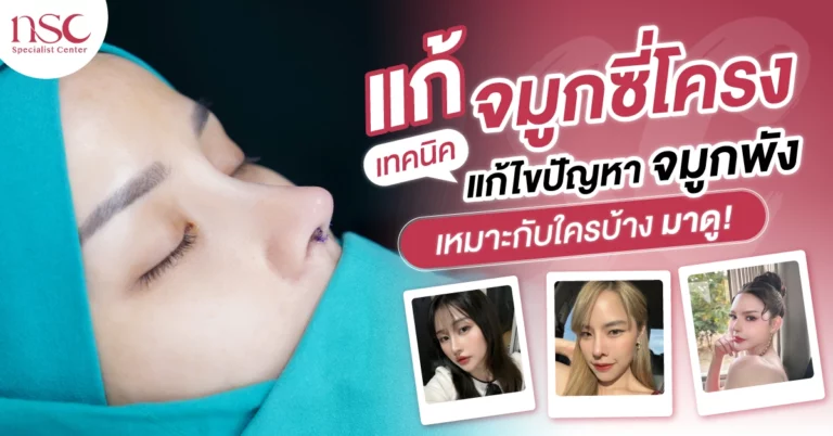 แก้จมูกซี่โครง เทคนิคแก้ไขปัญหาจมูกพัง เหมาะกับใครบ้าง มาดู!
