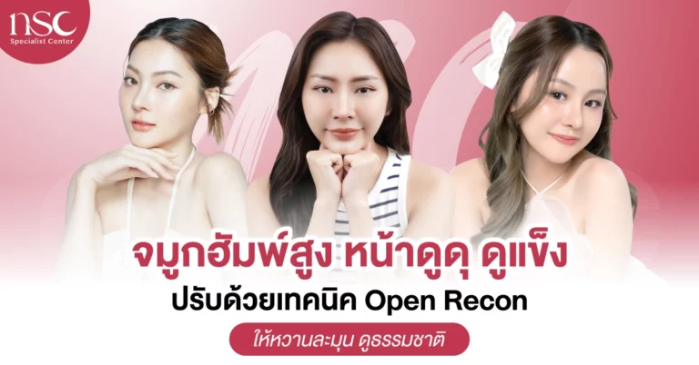 จมูกฮัมพ์สูง หน้าดูดุ ดูแข็ง ปรับด้วยเทคนิค Open Recon ให้หวานละมุน ดูธรรมชาติ