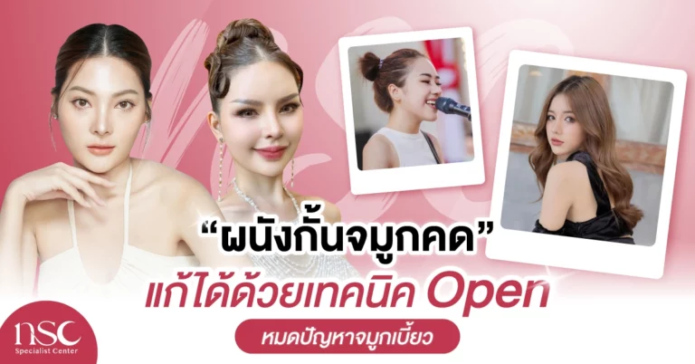“ผนังกั้นจมูกคด” แก้ได้ด้วยเทคนิค Open หมดปัญหาจมูกเบี้ยว