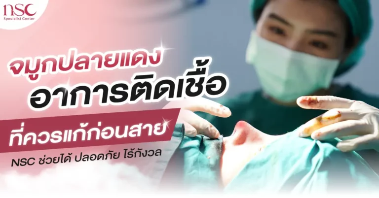 จมูกปลายแดง