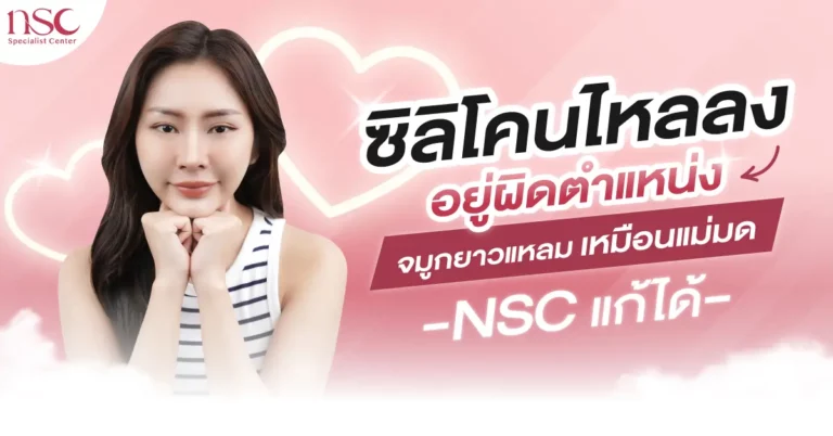 ซิลิโคนไหลลง