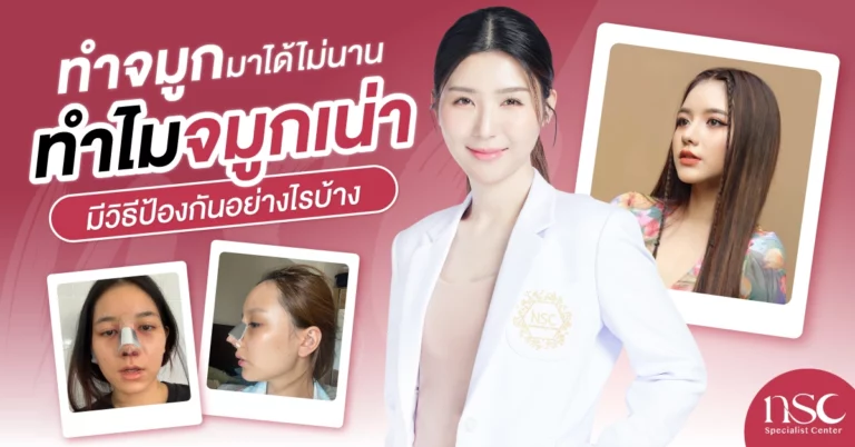 ทำจมูกมาได้ไม่นาน ทำไมจมูกเน่า มีวิธีป้องกันอย่างไรบ้าง