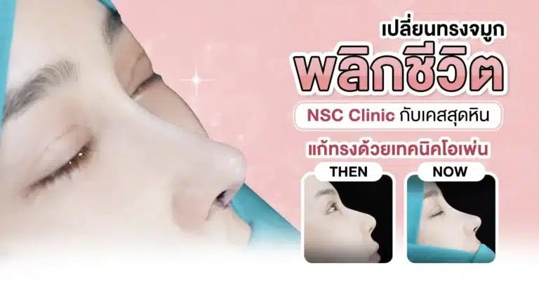 เปลี่ยนทรงจมูก