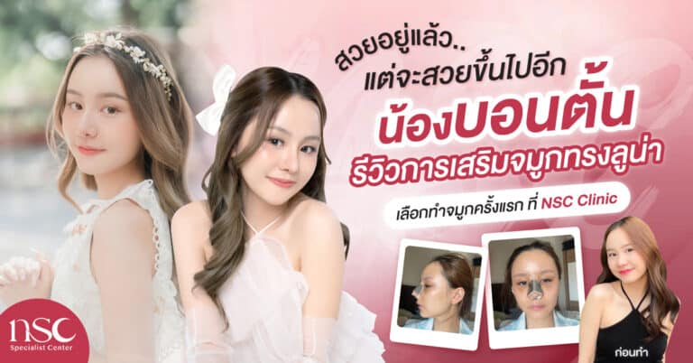 รีวิวการเสริมจมูกทรงลูน่า เลือกทำจมูกครั้งแรก ที่ NSC Clinic