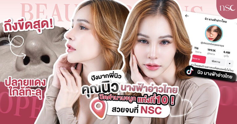 ปิดตำนานจมูกแท่งที่ 10 คุณนิว นางฟ้าอ่าวไทย ถึงขีดแดงใกล้จะทะลุ ขอจบที่ NSC CLINIC ด้วยเทคนิค Lunar Rib Graft
