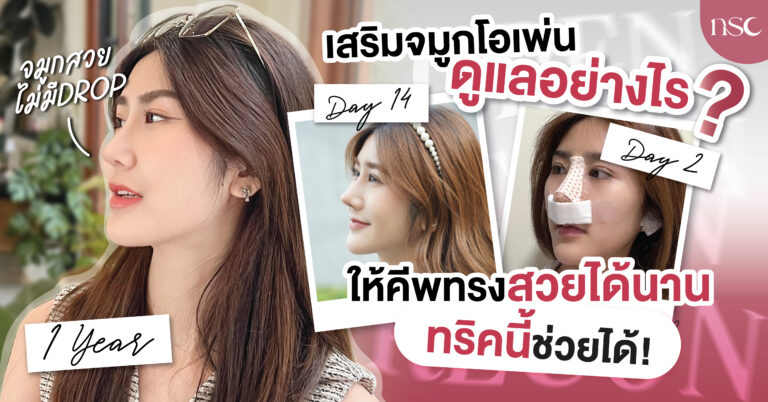 เสริมจมูกโอเพ่น ดูแลยังไง คีพทรงให้สวย พุ่ง ได้นาน ๆ ทริคนี้ช่วยได้!