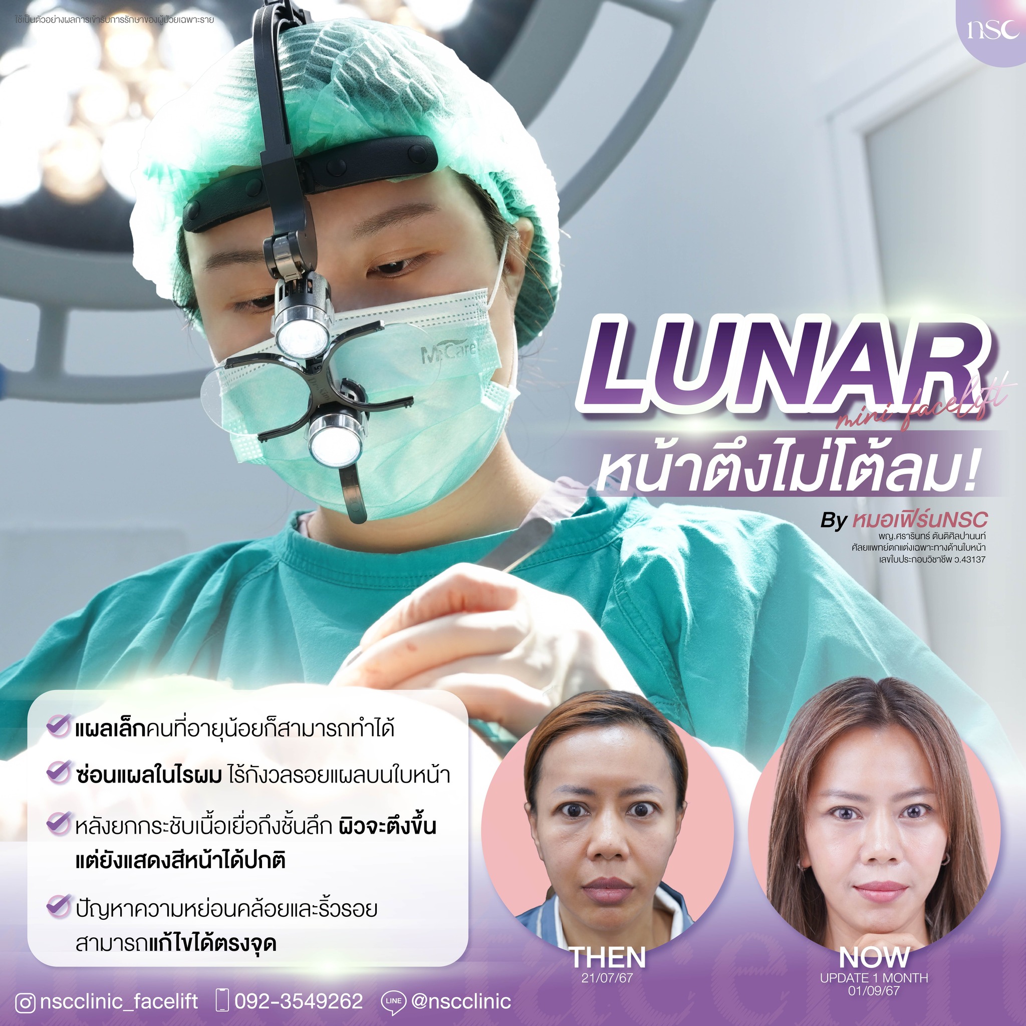 ดึงหน้า ที่ NSC Clinic