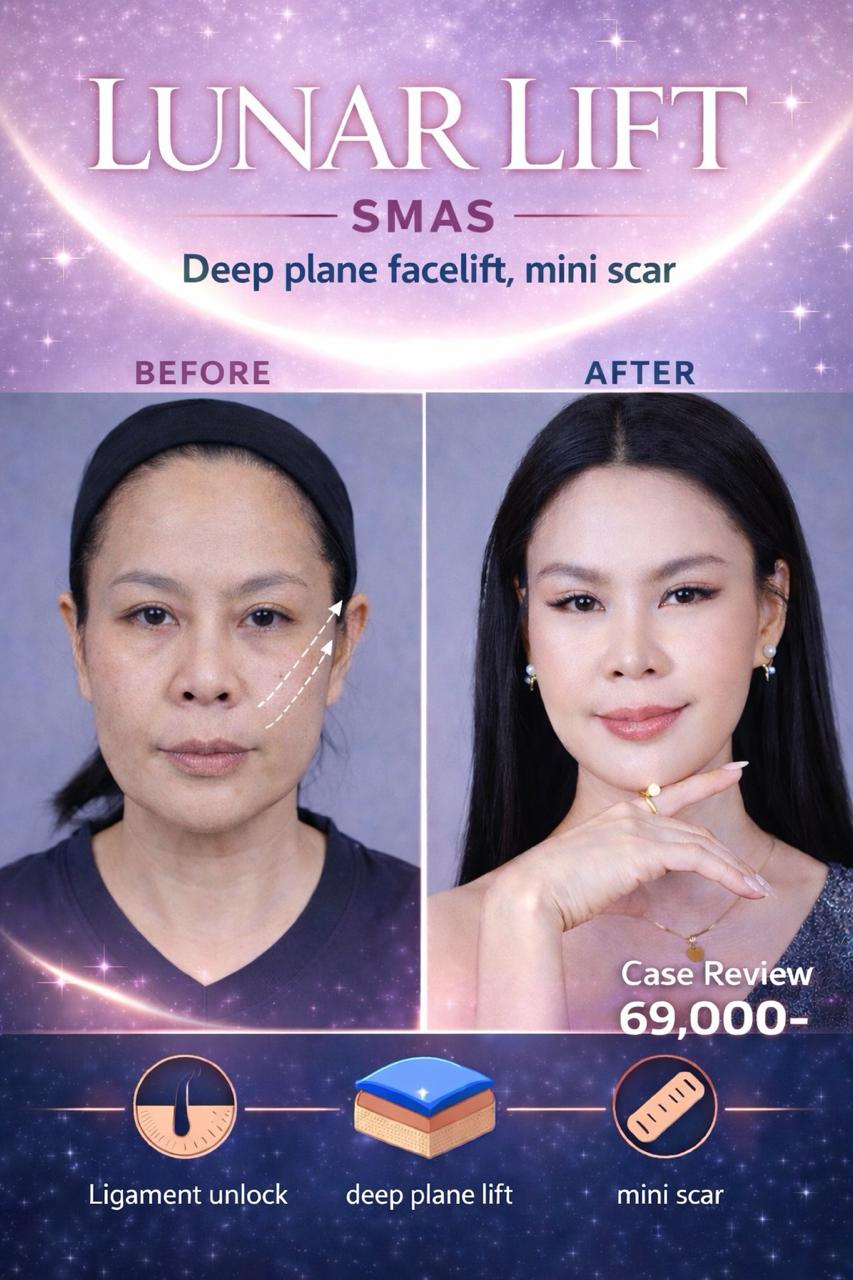 ดึงหน้า ความแตกต่าง