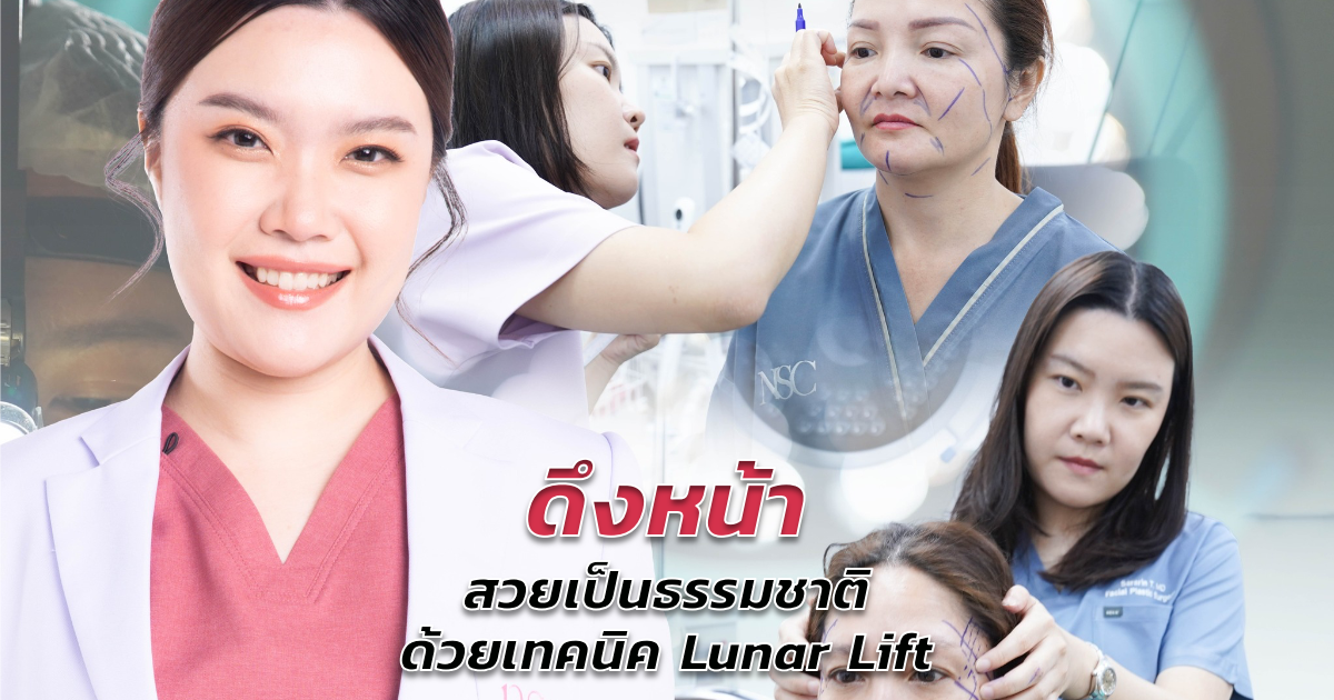 ดึงหน้า